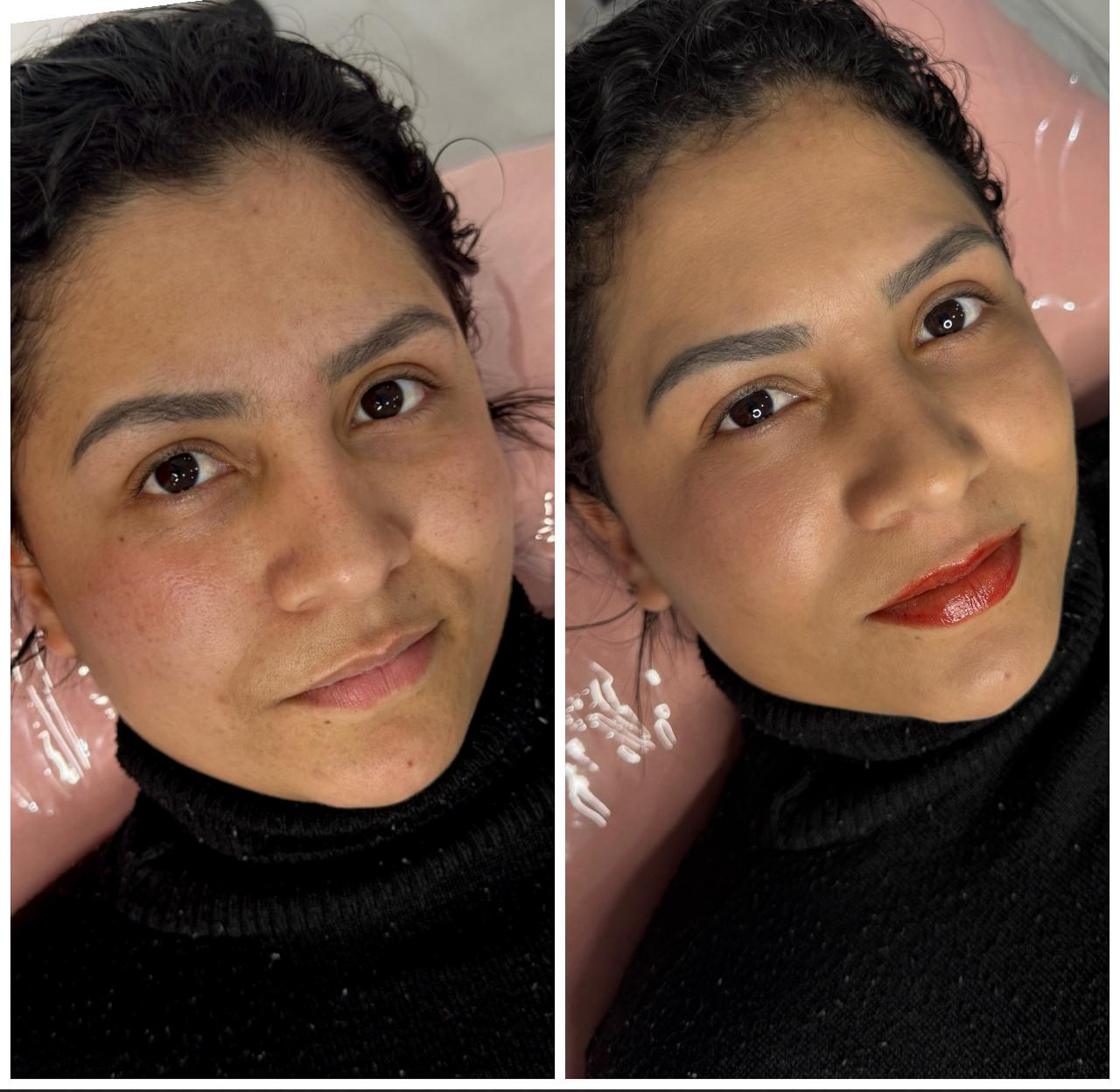 Comparativo Acorde Linda — cliente 2