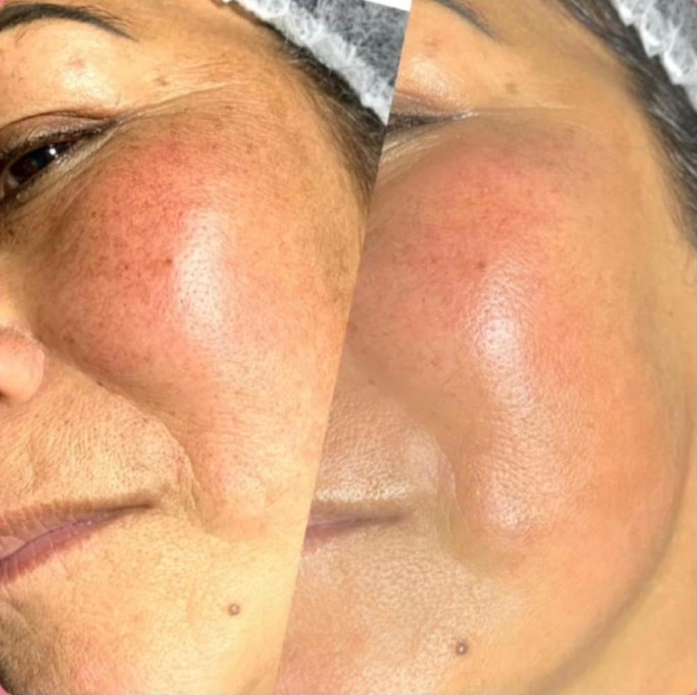 Procedimentos de beleza
