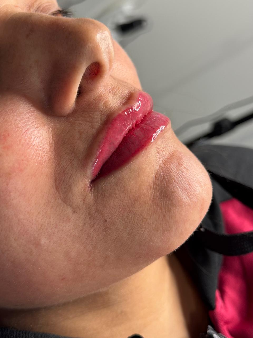 Depois da micropigmentação labial